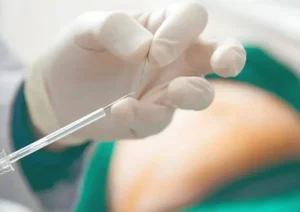 کاشت نخ لاغری