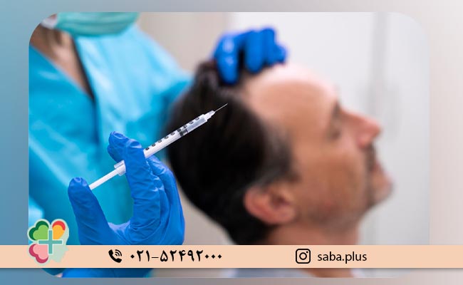 روش درمانی مزوتراپی مو چگونه است؟